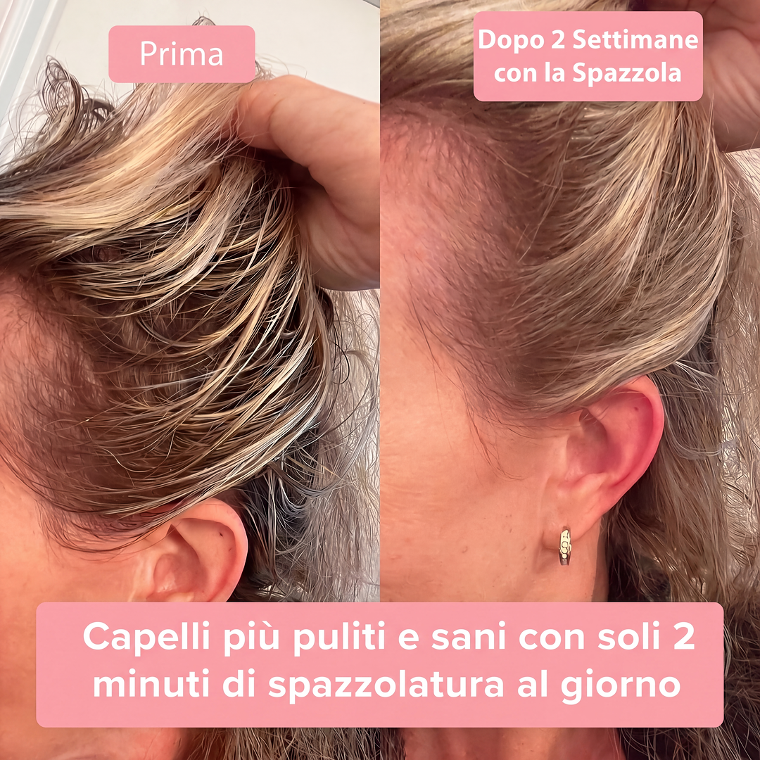 Spazzola Anti-Caduta per Capelli